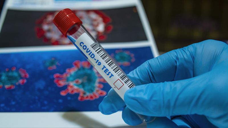 Бір тәулікте 66 қазақстандықтан коронавирус анықталды