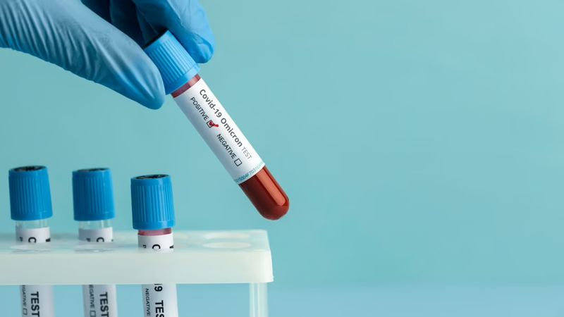 тест на коронавирус В Казахстане наблюдается спад суточной заболеваемости коронавирусом