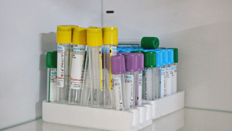 ПЦР-тесты пробирки