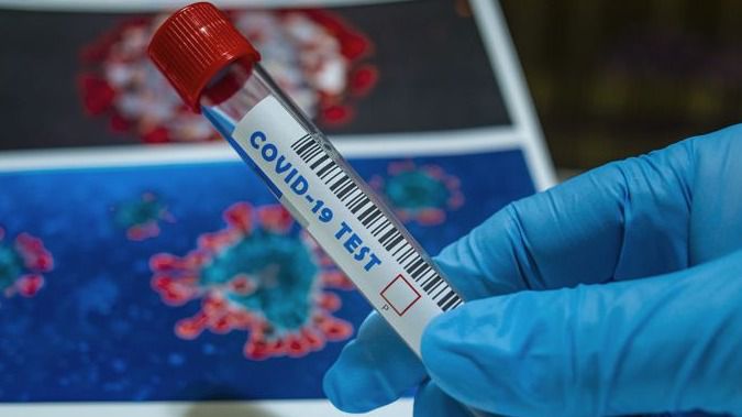 Статистика по COVID-19 Статистика по COVID-19: 66 казахстанцев заразились коронавирусом за сутки